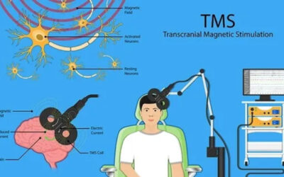 What Can Be Treated With TMS Therapy?