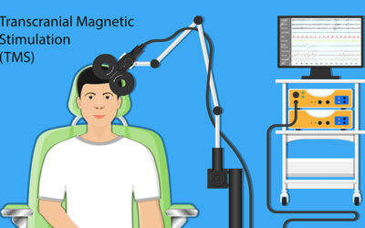 What Type of Depression Does TMS Treat?