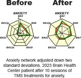 Graphical depiction of anxiety improvement, illustrating the contrast between high anxiety levels before and lower levels after intervention.